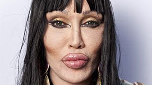 'Celebrities Who Destroyed Their Careers With Plastic Surgery'