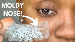 'AFFORDABLE SKIN CARE HACK FOR CLEANING CLOGGED PORES | HERO COSMETICS MIGHTY PATCH FACE REVIEW'