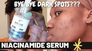 'TRYING IT Cosmetics Bye Bye Dark Spots Niacinamide Serum | Acne Prone | Oily | Dark Skin | Update'