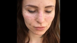 'So People Are Actually Tattooing Freckles On Their Face Now'