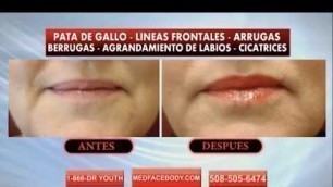 'Dr. Dave David Botox and Facial Fillers TV Commercial in Spanish'