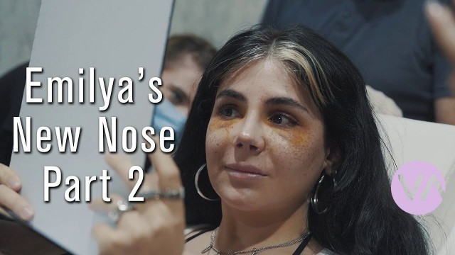 'Emilya\'s New Nose Part 2 - Rhinoplasty in Vanity Cosmetic Surgery Hospital #rhinoplasty #istanbul'