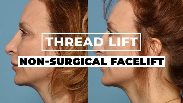 'What is a Thread Lift? | Non-Surgical Facelift Alternative'