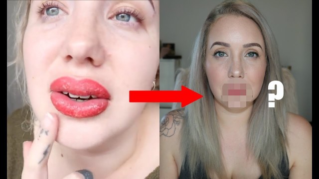 'My Lips-  1 YEAR LATER'