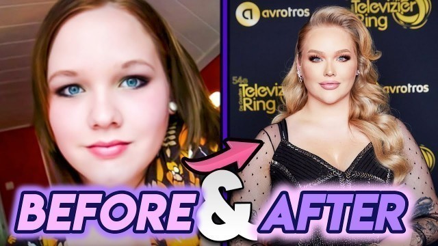 'NikkieTutorials | Before and After Transformations | Her Cosmetic Surgery and More'