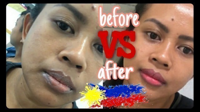 'Sinubukan kong magpa Lip Tattoo masakit ba? from day 1 - 30 days update | Prettylooks Davao'