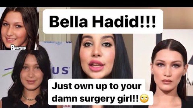 'BELLA HADID - before and after plastic surgery MANAM TALKS'