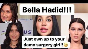 'BELLA HADID - before and after plastic surgery MANAM TALKS'