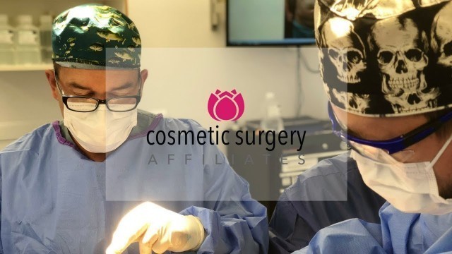 'Tummy Tuck | Cosmetic Surgery Affiliates'