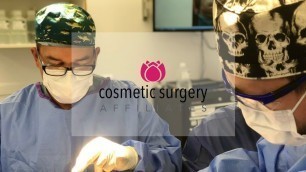 'Tummy Tuck | Cosmetic Surgery Affiliates'