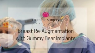 'Breast Re-Augmentation from Silicone to Gummy Bear Implants | Cosmetic Surgery Affiliates'