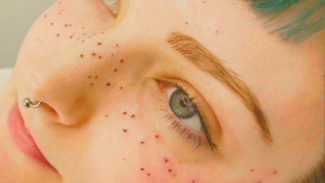 'Are freckle tattoos the latest beauty trend?'