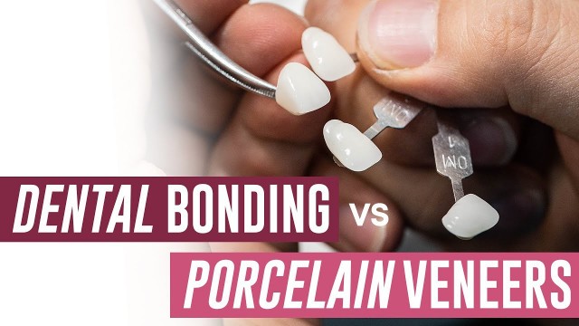 'Dental Bonding vs Porcelain Veneers - Which Should I Get?'