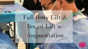 'Full Body Lift & Breast Lift w/ Augmentation| Cosmetic Surgery Affiliates'