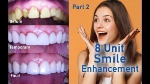 'Transform your Smile with Dental Porcelain Veneers - Live Cosmetic Dental Procedure - Part 2'