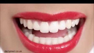 'Dental cosmetics, 20 most beautiful teeth  The secret to keeping the teeth healthy'