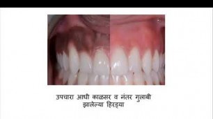 'Cosmetics Dentistry By SPDC'