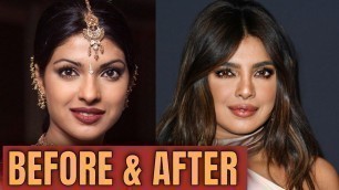 'Priyanka Chopra; Plastic (Cosmetic ) Surgery  2020'