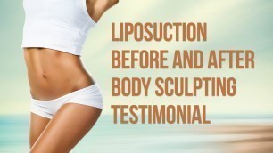 'Liposuction Surgery (before and after) body sculpting Vanity Cosmetic Surgery Video'