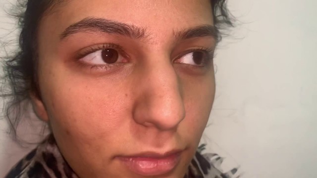 'Rhinoplasty Or Surgical Permanent Cosmetic Nose reshaping surgery video in Bangalore -Dr Richardson'