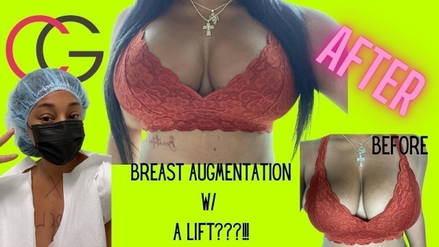 'CG Cosmetics | Breast Augmentation W/ Lift | Dr. Freiman | Gummy Bear Implants |'