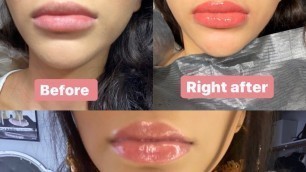 'LIP TINTING (Permanent make up) 