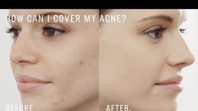 'ASK A PRO ARTIST: How To Cover Acne with Foundation by Bobbi Brown Cosmetics'