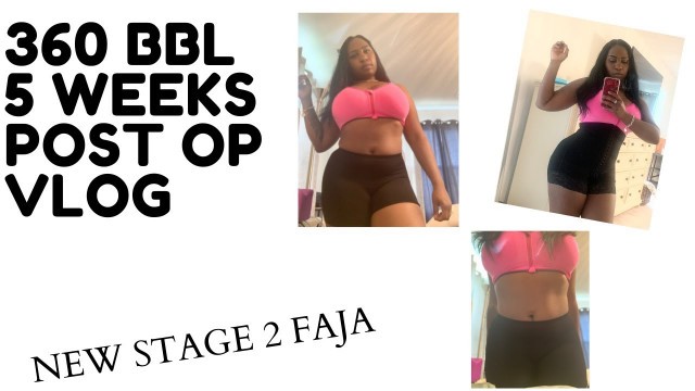 '5 WEEKS POST OP BBL RECOVERY VLOG | STAGE 2 FAJA | CG COSMETICS | BBL'