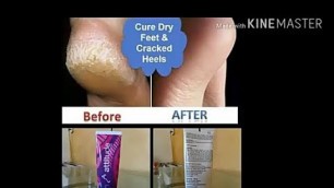 'Amway Attitude Foot Cream Review|Cure Dry Feet and Cracked Heel'